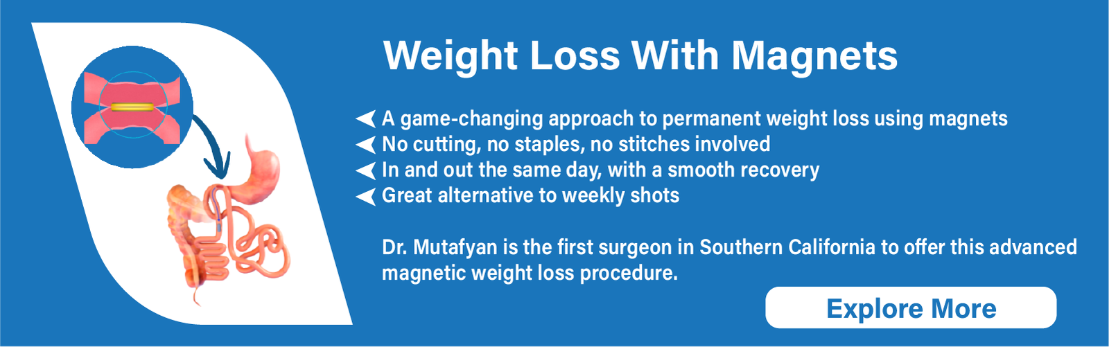 Weight Loss With Magnets