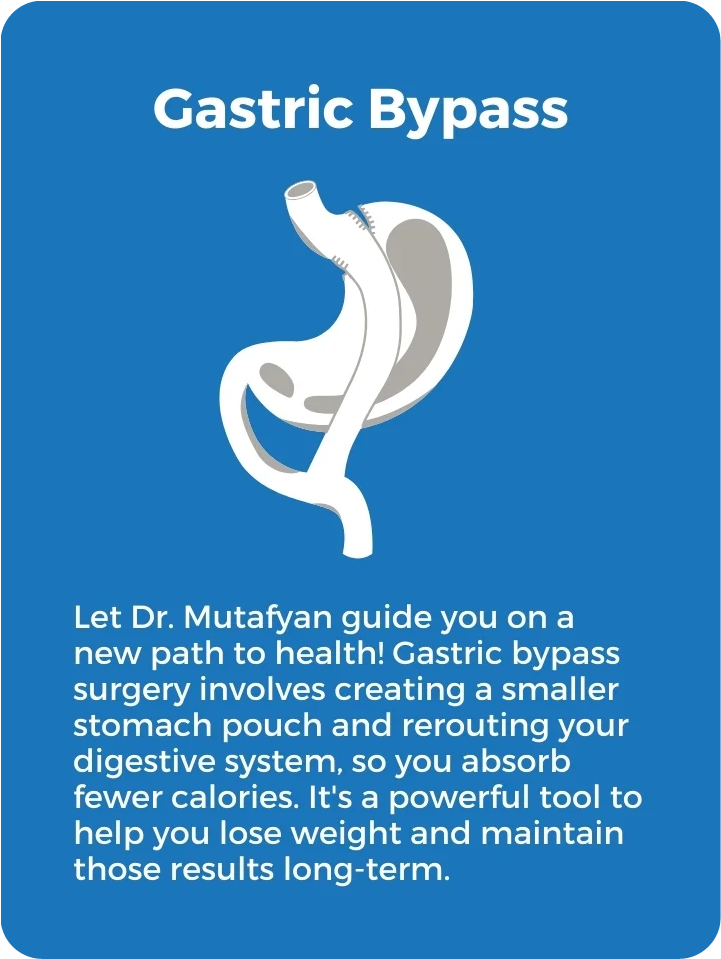 gastric-bypass